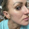 Michael D. Marion, MD - Marion Plastic Surgery & Med Spa gift card