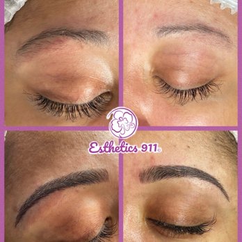 Esthetics 911 - Micro-balding, eyelash extension - Skin Care Near Me - Torrance, California