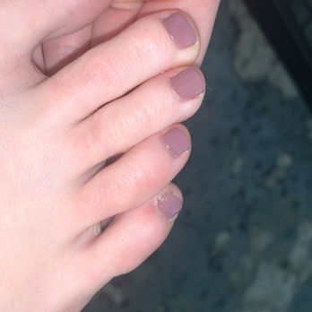 Magic Star Nails - Painted skin, messed up pinky toe - Nail Salons Near Me - Chicago, Illinois