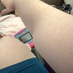 BioLife Plasma Services - Lump on my arm right after service