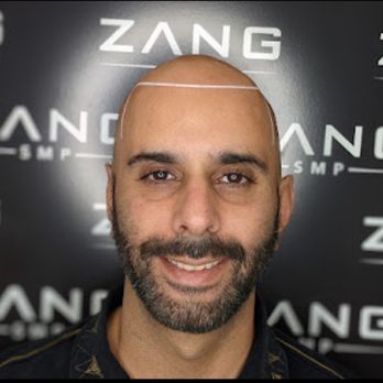 Zang SMP - Hair Loss Centers Near Me - Los Angeles, California