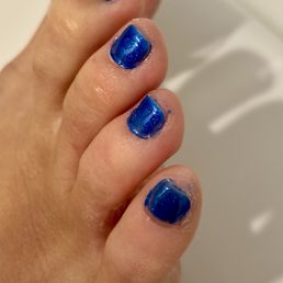 Polish is all over the skin