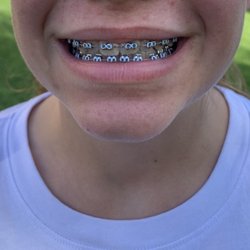 Freedom Orthodontics