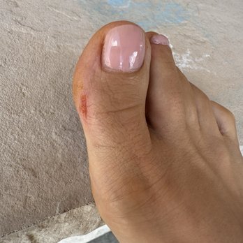 Allure Nail Bar - Really bad deep cut into my skin - Nail Salons Near Me - Longmont, Colorado Allure Nail Bar - Really bad deep cut into my skin - Nail Salons Near Me - Longmont, Colorado