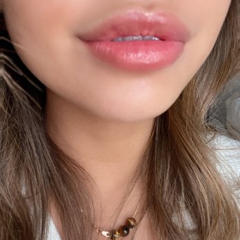 Locococo Aesthetix - After - Medical Spas Near Me - Aiea, Hawaii