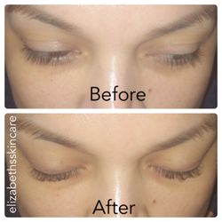 Elizabeth's Skin Care - Eyelash Lift