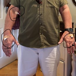 Drawing blood results should not look like this!