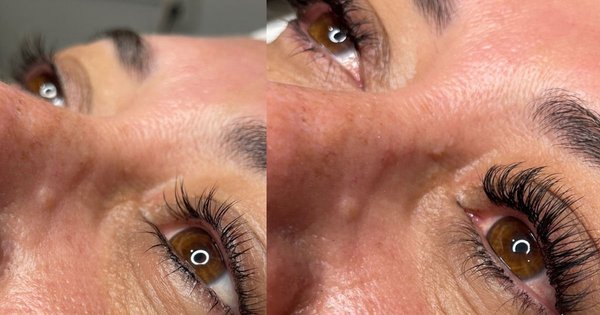 Luminous Face & Body Esthetics