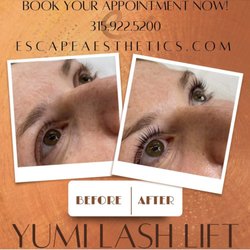 Escape Medical - Yumi Lash Lift results