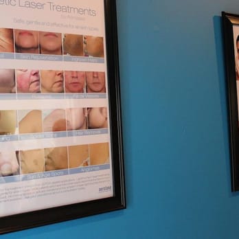 Harlem Zen - We offer a wide variety of treatments from hair removal to scar removal...we even treat nail fungus and spider veins. - Skin Care Near Me - New York, New York Harlem Zen - We offer a wide variety of treatments from hair removal to scar removal...we even treat nail fungus and spider veins. - Skin Care Near Me - New York, New York