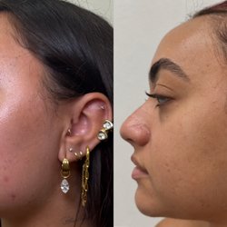 Get Glowing Medspa