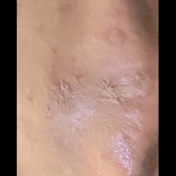 NassifMD Medspa - This is how it was before the Botox and face products they have and recommended - Cosmetic Surgeons Near Me - Beverly Hills, California NassifMD Medspa - This is how it was before the Botox and face products they have and recommended - Cosmetic Surgeons Near Me - Beverly Hills, California