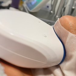 Aimsbodysculpting - Double chin cool sculpting sessions $25 per session
