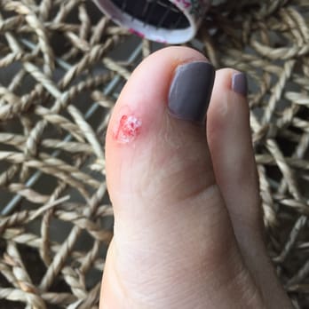 Diva Nails - The cut on my toe! - Nail Salons Near Me - Mount Juliet, Tennessee Diva Nails - The cut on my toe! - Nail Salons Near Me - Mount Juliet, Tennessee