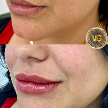 VitaGlowMD - Medical Spas Near Me - San Jose, California VitaGlowMD - Medical Spas Near Me - San Jose, California