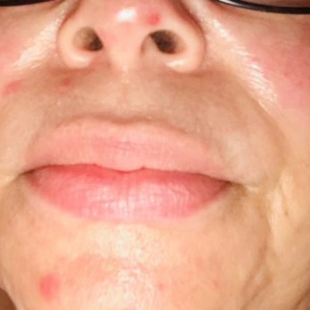 Tracy Katz, MD - Dermatologists Near Me - Houston, Texas Tracy Katz, MD - Dermatologists Near Me - Houston, Texas