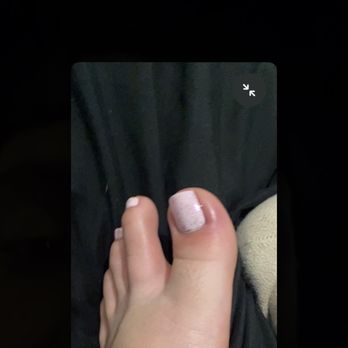 Allure Nails & Spa - Side angle of how bruised. - Waxing Near Me - Lake Elsinore, California Allure Nails & Spa - Side angle of how bruised. - Waxing Near Me - Lake Elsinore, California