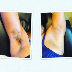Lady Sammy Waxing Studio - Before and after arm wax