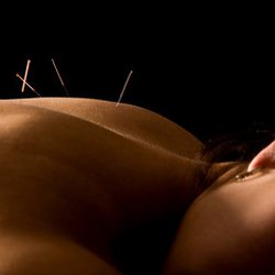 Rein Center - We now offer acupuncture; Individual treatments or group session in in relaxation lounge.