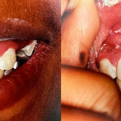 The Office of Keith G. Lorio - Before & After Results at The Office of Keith G. Lorio, DDS| Baton Rouge, LA
