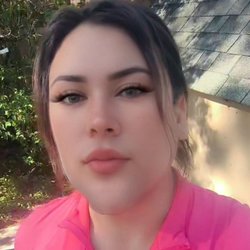 Beautiful Body Sculpting - So happy with my results! My jawline is more defined, my face looks more feminine, and I feel confident.