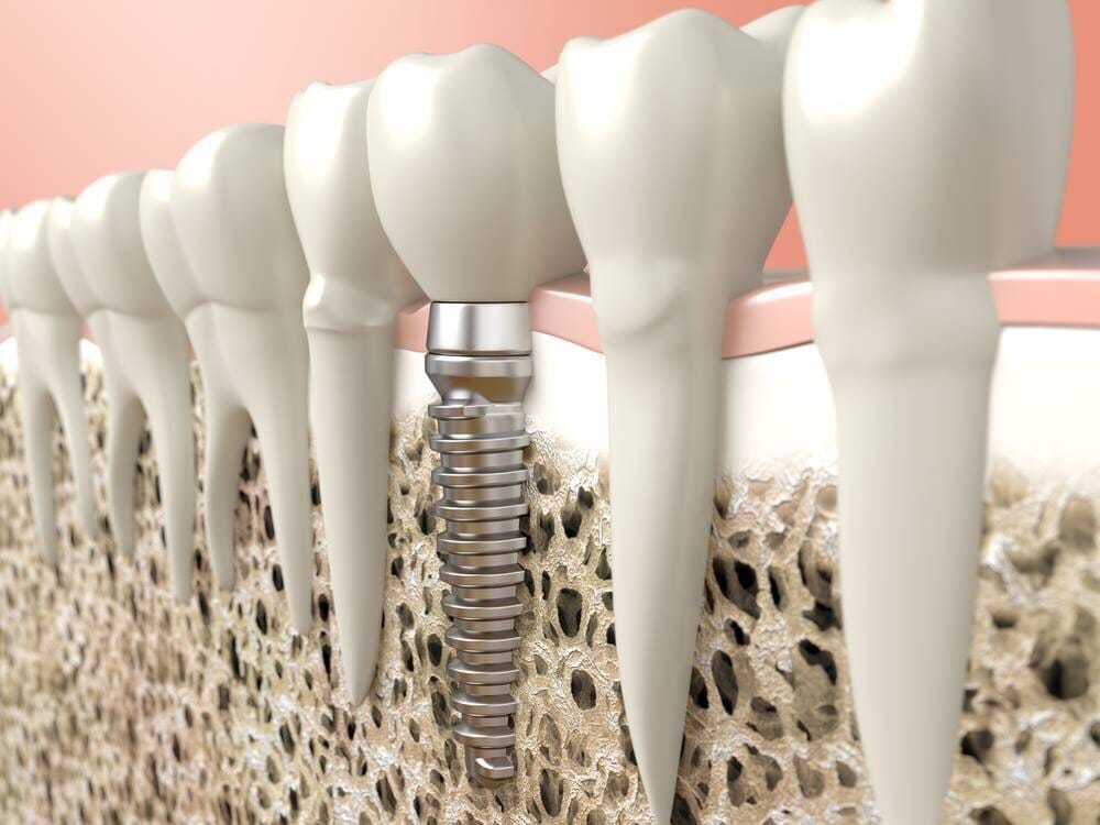 4Dental