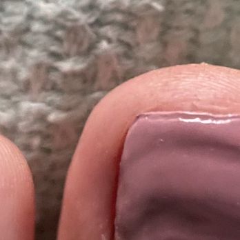 Dragon Nails Spa Corporation - Poorly cut down and shaped pedi - Nail Salons Near Me - Raynham, Massachusetts