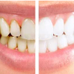 Explore Dental