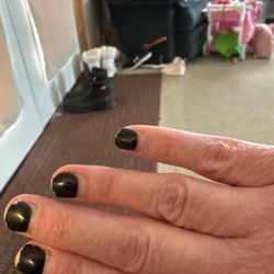 Luxury Nails Studio - My fingers and nails are completely infected and had to get treatment from a doctor.