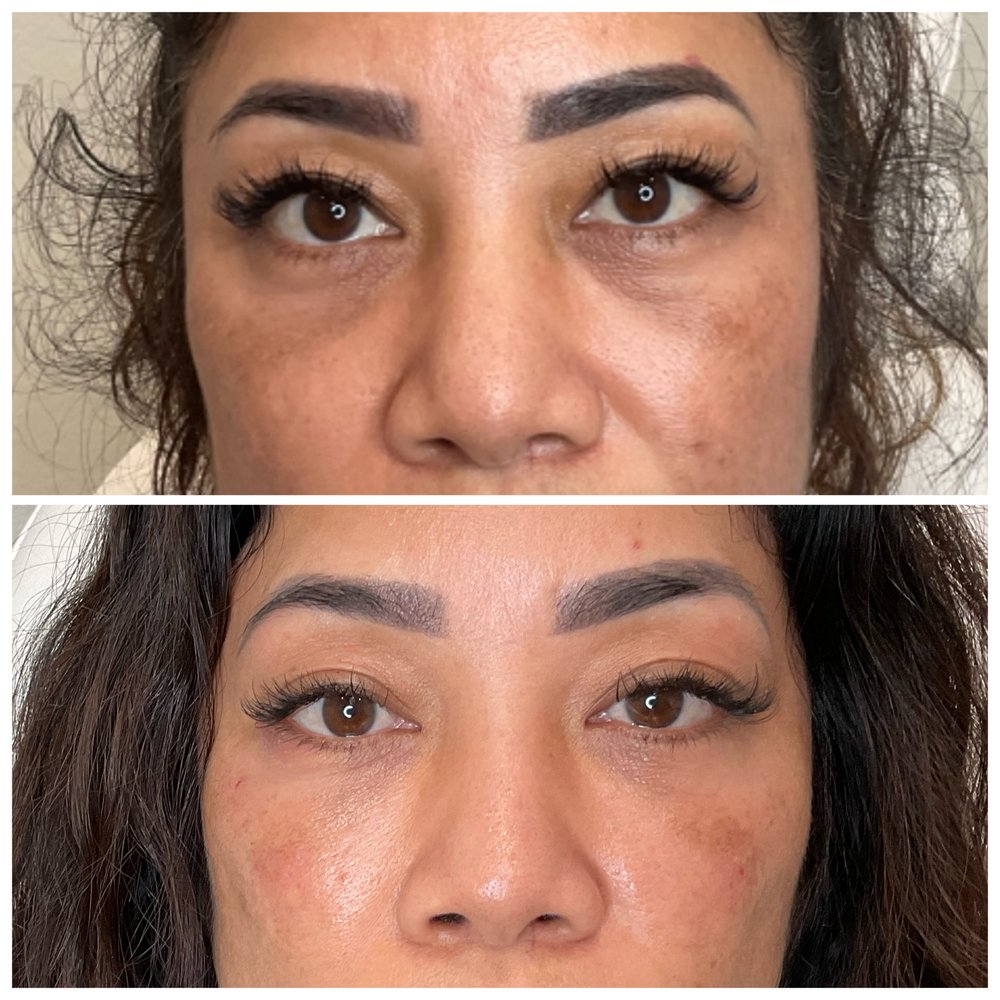 ESSENCE SKIN SPA 164 Photos 725 S 6th Ave, Kalispell, Montana