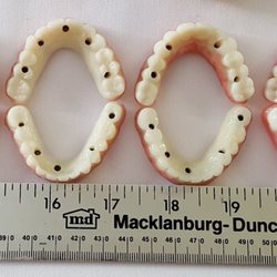 Dental Arts of Cherry Hills - So many different sizes and bites.