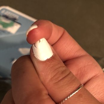 Polish Pros - 8 hours after manicure was "fixed" by Moon. - Nail Salons Near Me - San Diego, California Polish Pros - 8 hours after manicure was "fixed" by Moon. - Nail Salons Near Me - San Diego, California