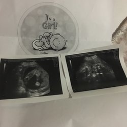 Clinica La Victoria - My ultrasound pics n the print out the lady made when I asked her not to tell us n to write it down she was awesome