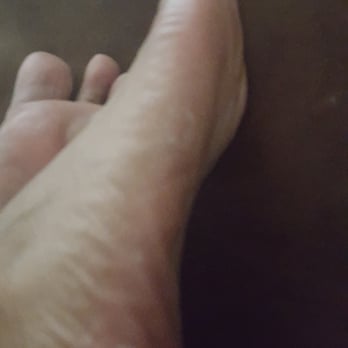 Nail Time Merced - Peeling on sides of feet. Same peeling on hands - Nail Salons Near Me - Merced, California Nail Time Merced - Peeling on sides of feet. Same peeling on hands - Nail Salons Near Me - Merced, California
