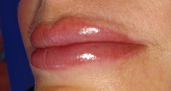 BrowWell for an amazing transformation 👏🏽 - at BrowWell achieve a more beautiful look with a cupids bow lift 👄 lipblushing procedure in beautiful cinnamon or your preferred lip color of choice 💄 BrowWell for an amazing transformation 👏🏽 - at BrowWell achieve a more beautiful look with a cupids bow lift 👄 lipblushing procedure in beautiful cinnamon or your preferred lip color of choice 💄
