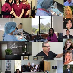 Hair Transplant San Diego