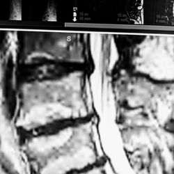 The Southeastern Spine Institute