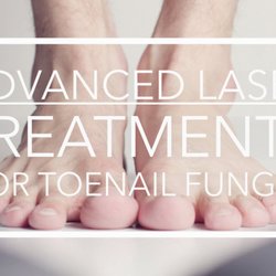Benjamin Scherer, DPM - Foot and Ankle - Advanced Treatments for Toenail Fungus available.  Call to set up a consultation and create a specialized treatment plan