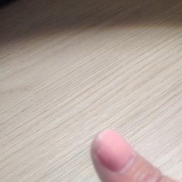 My other hand three days later