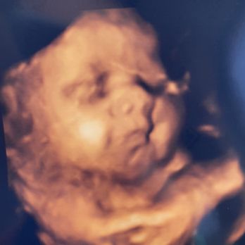 First Glimpse Imaging - Diagnostic Imaging Near Me - Austin, Texas First Glimpse Imaging - Diagnostic Imaging Near Me - Austin, Texas