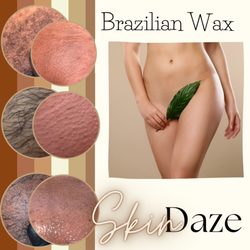 Skin Daze