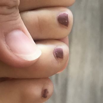 Front Street Inn & Spa - Paint only covers the nail partially, sometimes only halfway. - Day Spas Near Me - Morro Bay, California Front Street Inn & Spa - Paint only covers the nail partially, sometimes only halfway. - Day Spas Near Me - Morro Bay, California