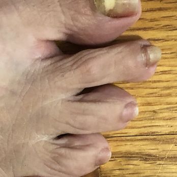 Peter's Nails - Right n left toenails - Nail Salons Near Me - Alice, Texas Peter's Nails - Right n left toenails - Nail Salons Near Me - Alice, Texas