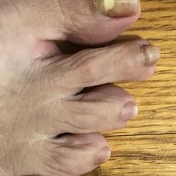 Peter's Nails - Right n left toenails