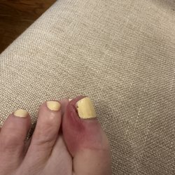 Pacific Nails Spa - Infection after nail tech caused bleeding and bacteria got under the nail
