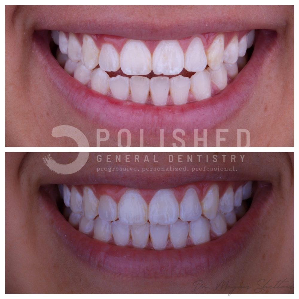 POLISHED GENERAL DENTISTRY 82 Photos & 158 Reviews 3144 El Camino