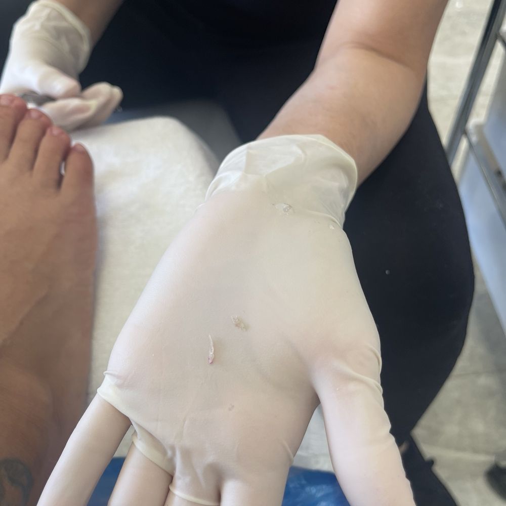Organic Nail & Spa - Me quito mis uñas enterradas - Nail Salons Near Me - Fontana, California Organic Nail & Spa - Me quito mis uñas enterradas - Nail Salons Near Me - Fontana, California
