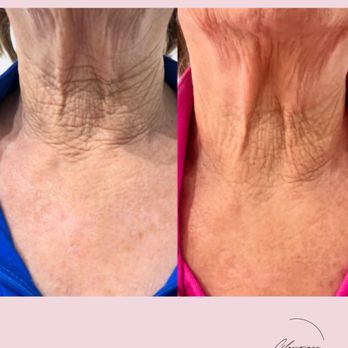 Glowrious Skin - Skin Care Near Me - Thousand Oaks, California Glowrious Skin - Skin Care Near Me - Thousand Oaks, California