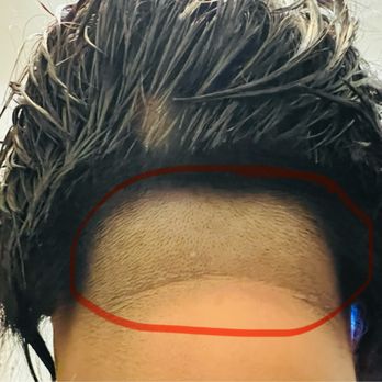 Nice Cuts - How can I go to work like this now? I've had to wear a scarf on hot days just to cover this up! I'm livid! Look at this ugly sh - Men's Hair Salons Near Me - San Francisco, California Nice Cuts - How can I go to work like this now? I've had to wear a scarf on hot days just to cover this up! I'm livid! Look at this ugly sh - Men's Hair Salons Near Me - San Francisco, California