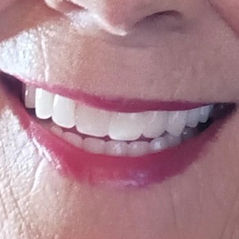Affordable Dentures & Implants - Dr. Lee and Dr. Shields thanks for my smile. - General Dentistry Near Me - Winchester, Virginia